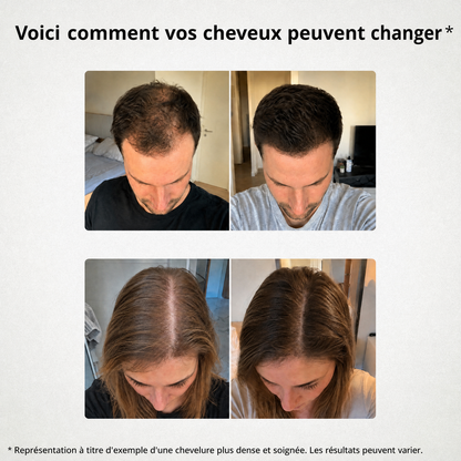 Représentation à titre d'exemple d'une chevelure plus dense et soignée