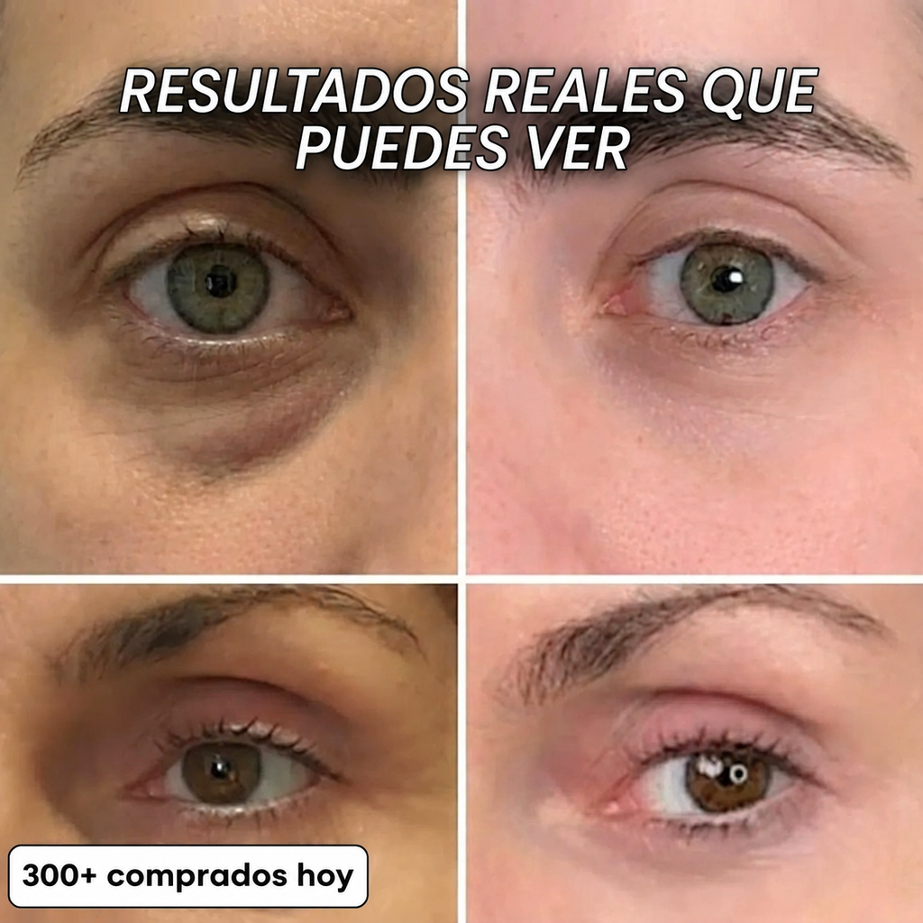 Stick rellenador colágeno PDRN Nakylo™